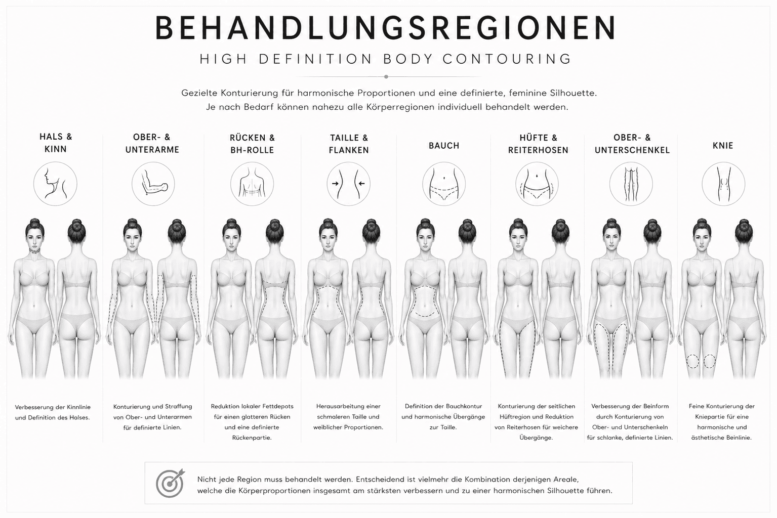 Behandlungsregionen des High Definition Body Contouring: Hals und Kinn, Arme, Rücken, Taille und Flanken, Bauch, Hüfte, Ober- und Unterschenkel, Knie