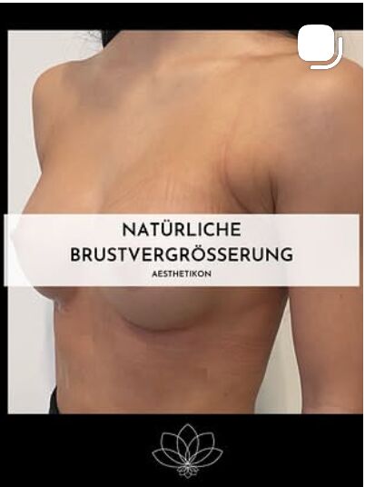 Natürliches Ergebnis – AESTHETIKON