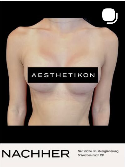 Natürliches Ergebnis – AESTHETIKON